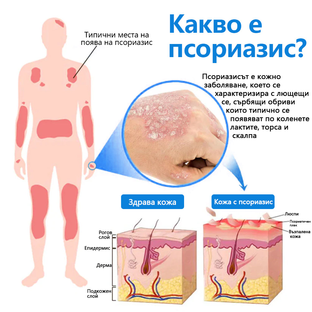 Официален магазин✅: Zvoevo® Магнезиев билков спрей за псориазис⚕️Сертифициран от FDA (облекчаване на псориазис и екзема, подобряване на бактериални инфекции в гениталната област и лечение на акне и тъмни петна)📦
