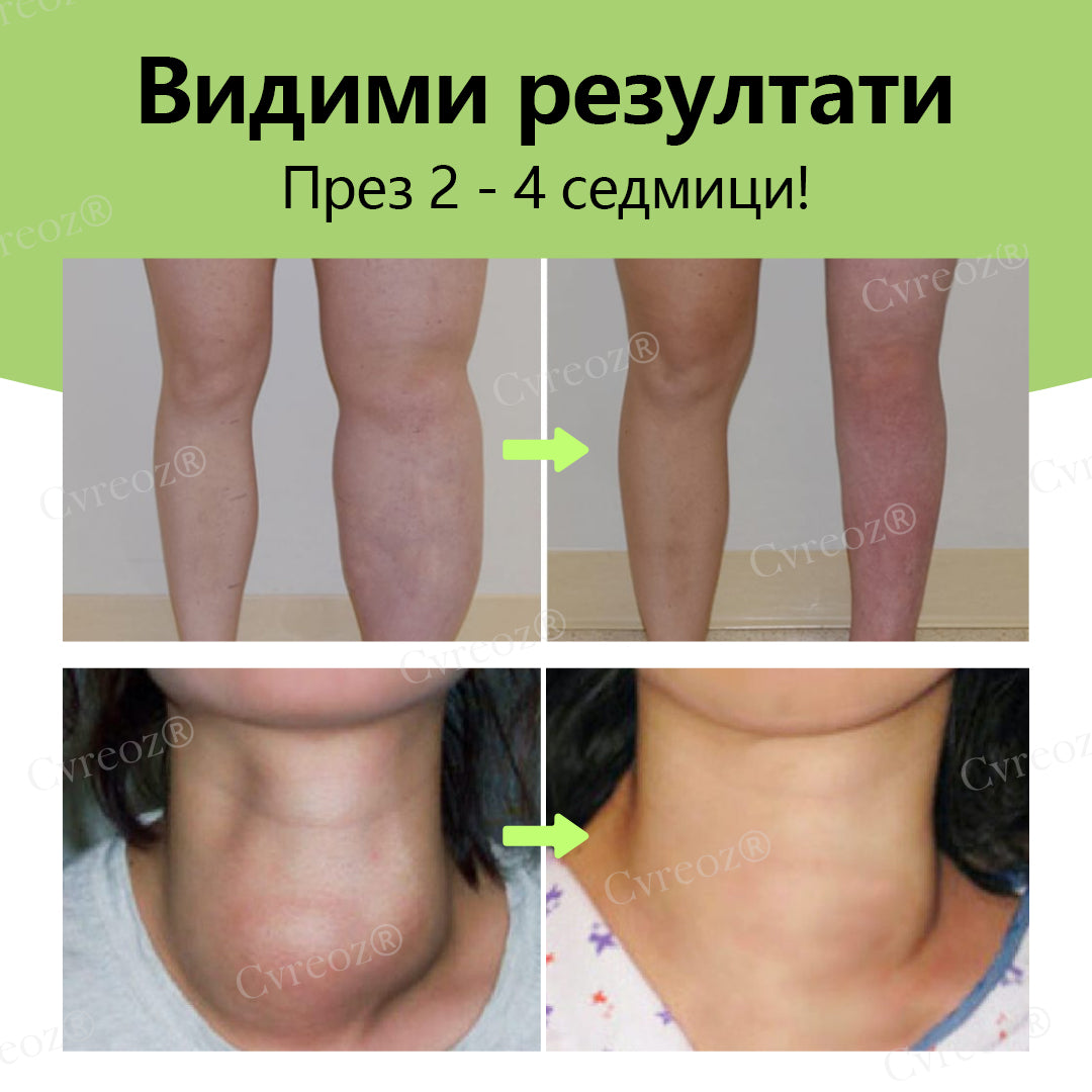 Cvreoz® Билков лимфен детокс крем📦