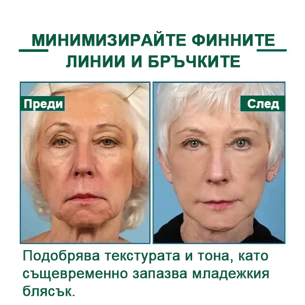 💝Последен ден на промоцията 60% отстъпка - Fubsta™ Укрепващ серум за подмладяване на кожата🔥