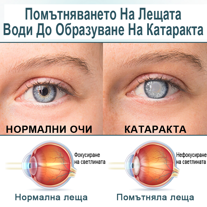 Капки за очи Optifusion Nano Serum – Нанотехнологията възстановява ясното зрение, без очила, без хирургическа намеса📦
