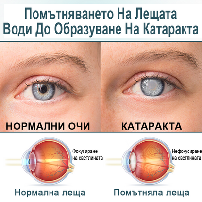 Капки за очи Optifusion Nano Serum – Нанотехнологията възстановява ясното зрение, без очила, без хирургическа намеса📦