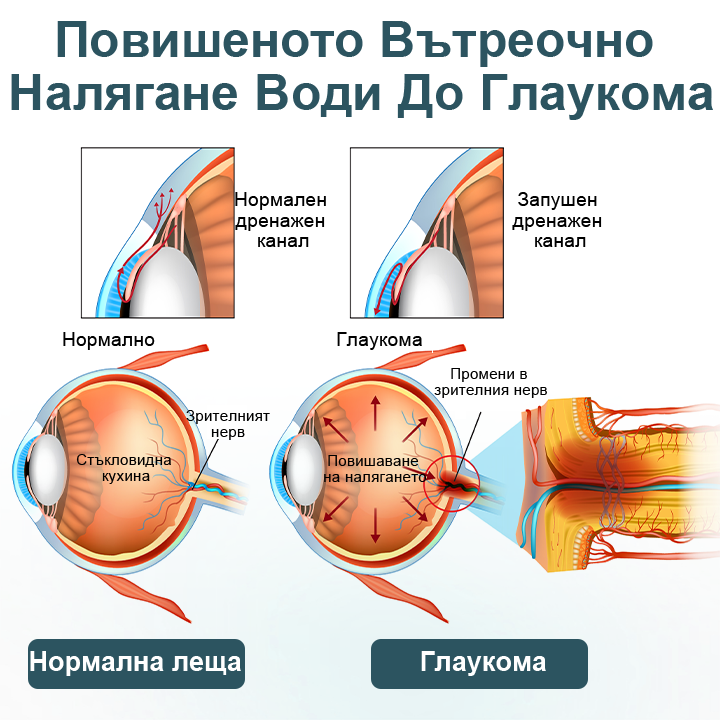 Капки за очи Optifusion Nano Serum – Нанотехнологията възстановява ясното зрение, без очила, без хирургическа намеса📦