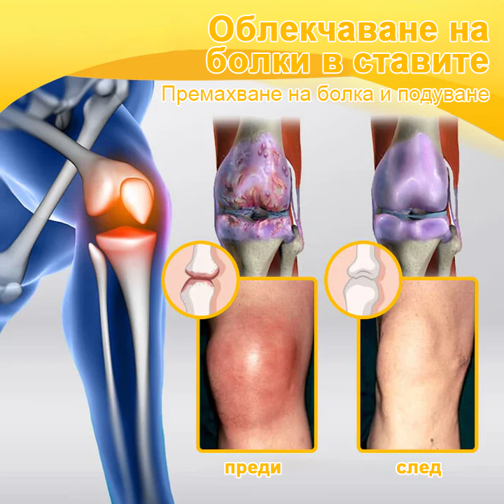 🌟TLOPA® Ботулинов токсин и Пчелна отрова Обезболяващ и Костнолечебен Крем🐝 🔥(Специално за възрастни хора & по препоръка на ортопедични специалисти) 🌿