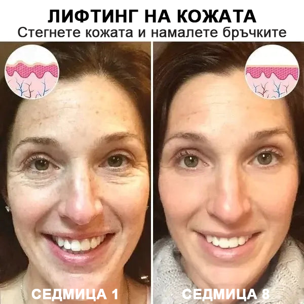 💝Последен ден на промоцията 60% отстъпка - Fubsta™ Укрепващ серум за подмладяване на кожата🔥