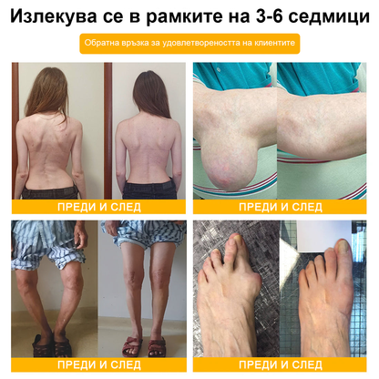 🌟TLOPA® Ботулинов токсин и Пчелна отрова Обезболяващ и Костнолечебен Крем🐝 🔥(Специално за възрастни хора & по препоръка на ортопедични специалисти) 🌿