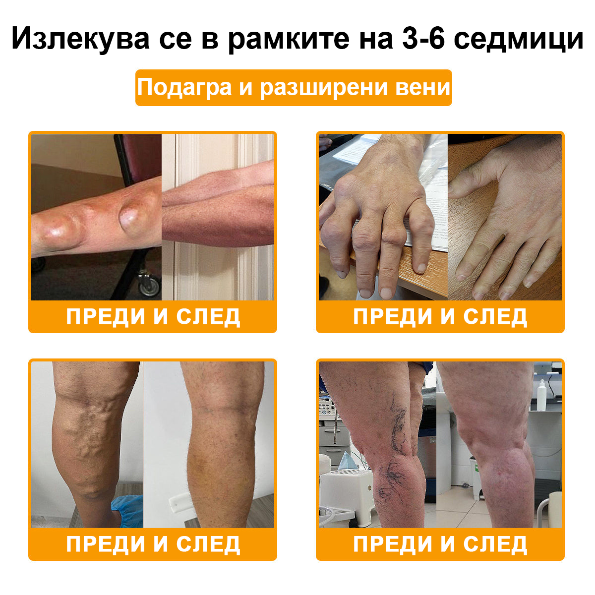 🌟TLOPA® Ботулинов токсин и Пчелна отрова Обезболяващ и Костнолечебен Крем🐝 🔥(Специално за възрастни хора & по препоръка на ортопедични специалисти) 🌿