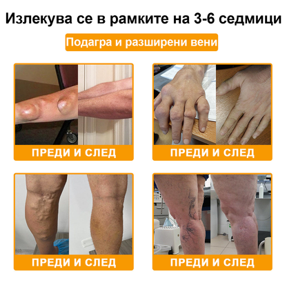 🌟TLOPA® Ботулинов токсин и Пчелна отрова Обезболяващ и Костнолечебен Крем🐝 🔥(Специално за възрастни хора & по препоръка на ортопедични специалисти) 🌿