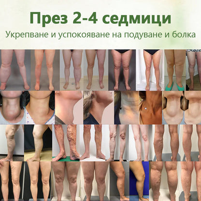 Cvreoz® Билков лимфен детокс крем📦