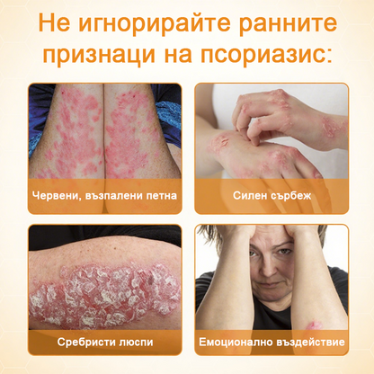 Timilk® BeeLieve Грижа за кожата при псориазис🎁