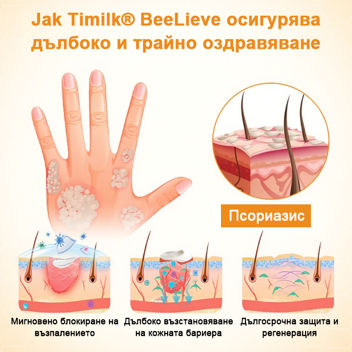 Timilk® BeeLieve Грижа за кожата при псориазис🎁