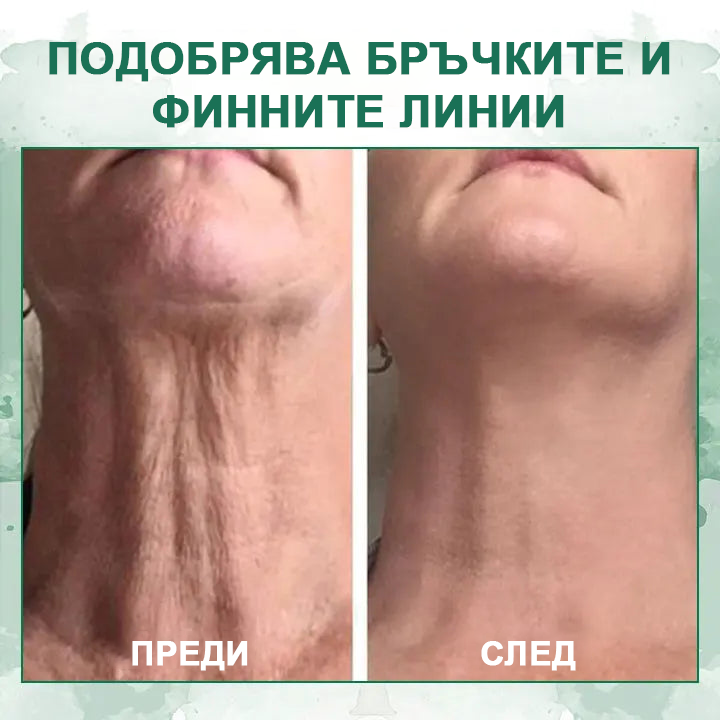 💝Последен ден на промоцията 60% отстъпка - Fubsta™ Укрепващ серум за подмладяване на кожата🔥