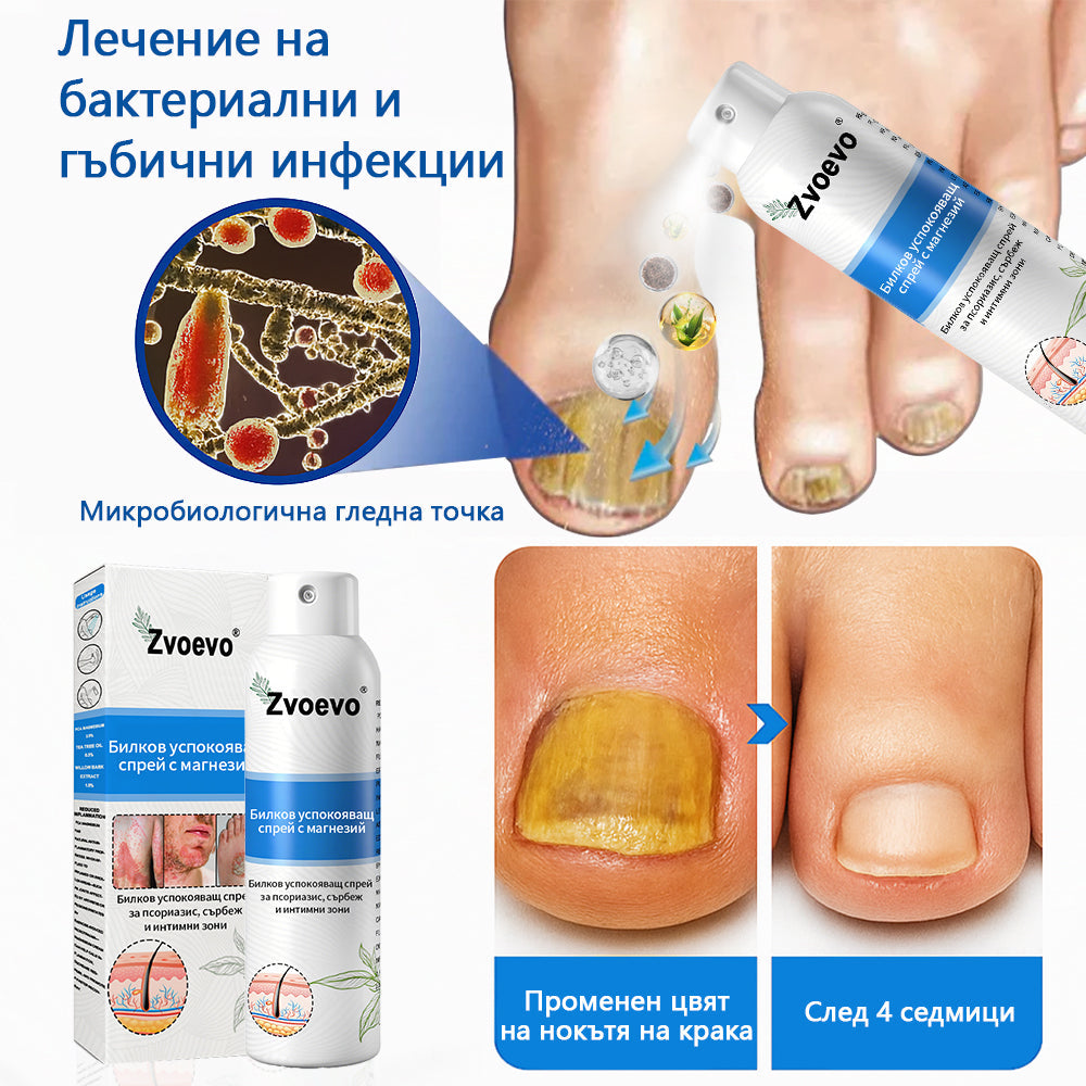 Официален магазин✅: Zvoevo® Магнезиев билков спрей за псориазис⚕️Сертифициран от FDA (облекчаване на псориазис и екзема, подобряване на бактериални инфекции в гениталната област и лечение на акне и тъмни петна)📦