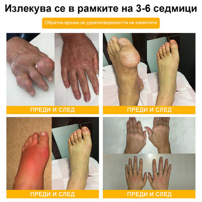 🌟TLOPA® Ботулинов токсин и Пчелна отрова Обезболяващ и Костнолечебен Крем🐝 🔥(Специално за възрастни хора & по препоръка на ортопедични специалисти) 🌿