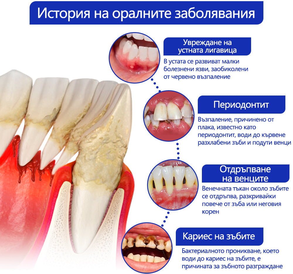 Furzero® Focussmile Прах за третиране с пчелна отрова за перорално приложение 🦷🎁
