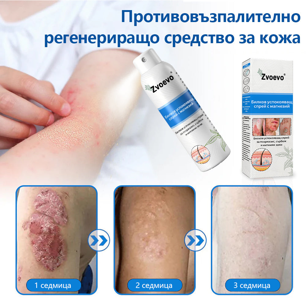 Официален магазин✅: Zvoevo® Магнезиев билков спрей за псориазис⚕️Сертифициран от FDA (облекчаване на псориазис и екзема, подобряване на бактериални инфекции в гениталната област и лечение на акне и тъмни петна)📦