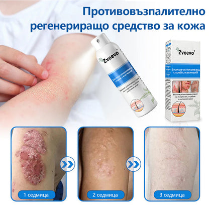 Официален магазин✅: Zvoevo® Магнезиев билков спрей за псориазис⚕️Сертифициран от FDA (облекчаване на псориазис и екзема, подобряване на бактериални инфекции в гениталната област и лечение на акне и тъмни петна)📦