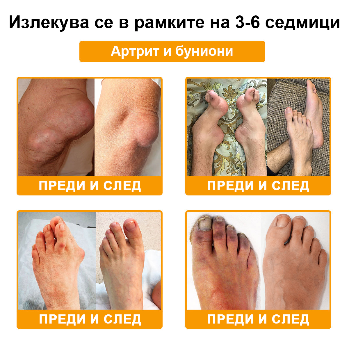 🌟TLOPA® Ботулинов токсин и Пчелна отрова Обезболяващ и Костнолечебен Крем🐝 🔥(Специално за възрастни хора & по препоръка на ортопедични специалисти) 🌿