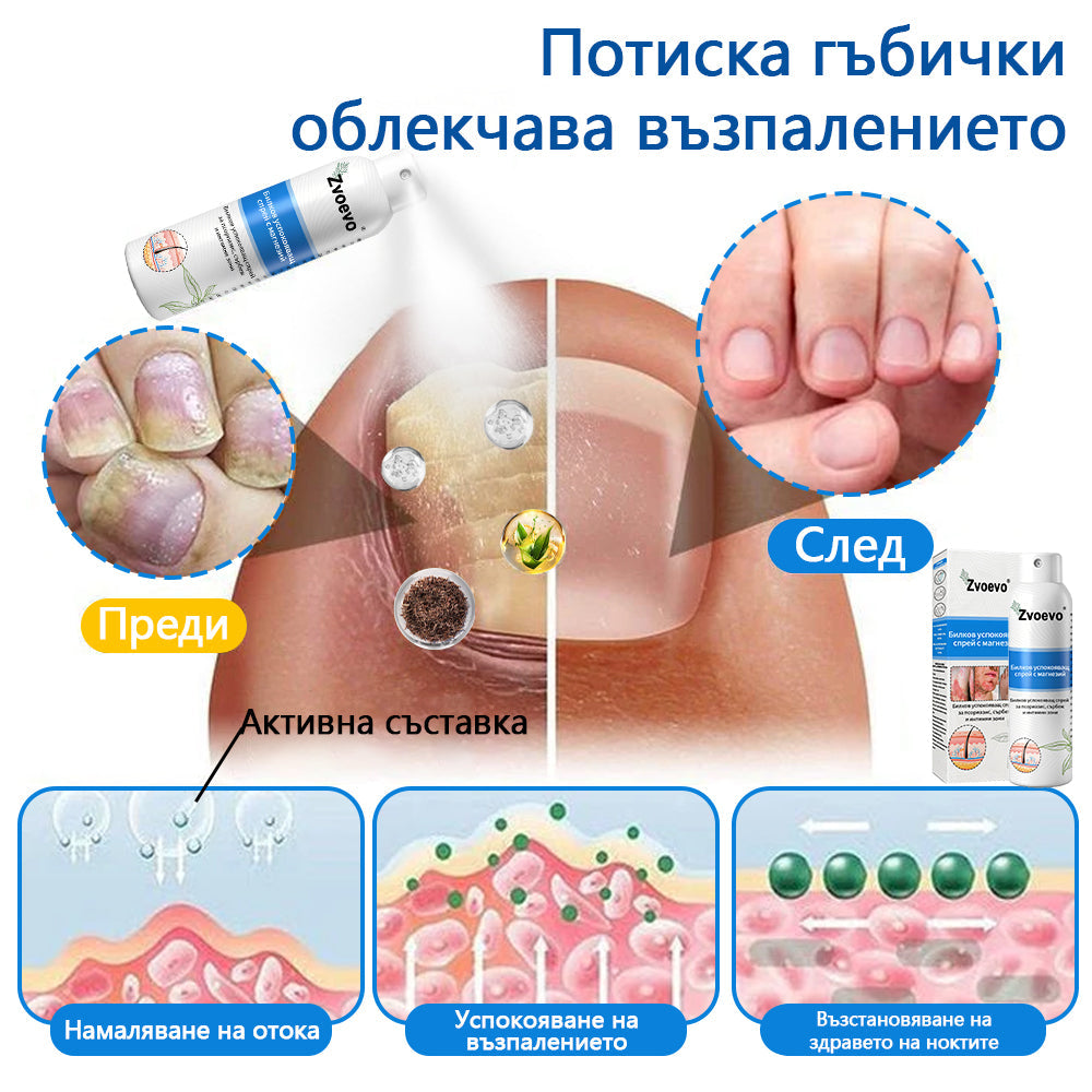 Официален магазин✅: Zvoevo® Магнезиев билков спрей за псориазис⚕️Сертифициран от FDA (облекчаване на псориазис и екзема, подобряване на бактериални инфекции в гениталната област и лечение на акне и тъмни петна)📦