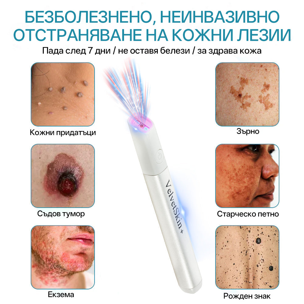 CO₂ лазерна писалка за премахване на 🟤 родилни белези, 🦠 брадавици, 🔘 петна и други кожни несъвършенства