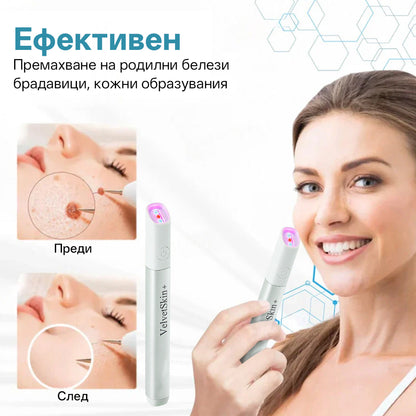 CO₂ лазерна писалка за премахване на 🟤 родилни белези, 🦠 брадавици, 🔘 петна и други кожни несъвършенства